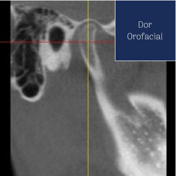 Dor Orofacial