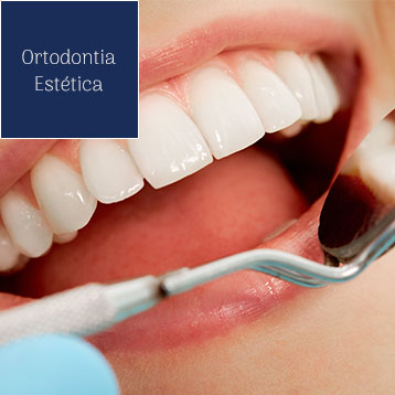 Ortodontia Estética