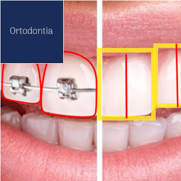 Ortodontia